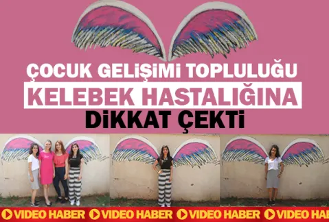Çocuk Gelişimi Topluluğu Kelebek Hastalığına Dikkat Çekti